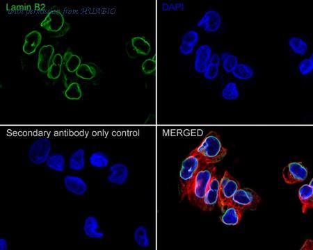 HUABIO HA601289 image 2