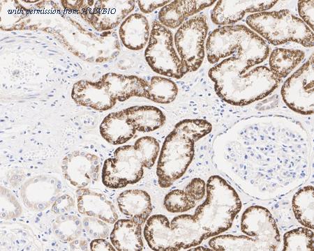 HUABIO HA601320 image 3