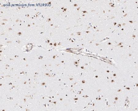 HUABIO HA601327 image 3