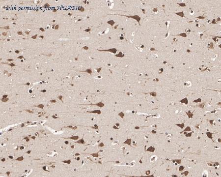 HUABIO HA601332 image 3