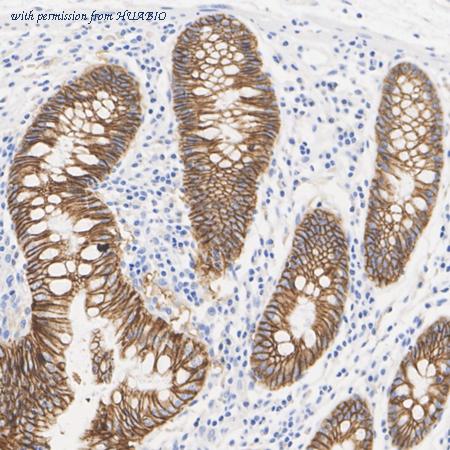 HUABIO HA601346 image 2