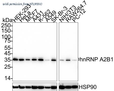 HUABIO HA601364 image 1