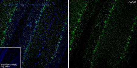 HUABIO HA601370 image 1