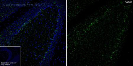 HUABIO HA601370 image 2