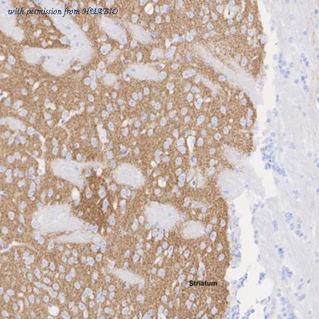 HUABIO HA601371 image 2