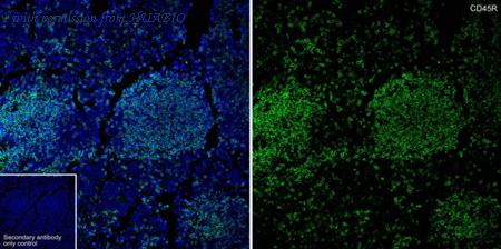 HUABIO HA601385 image 3