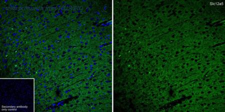 HUABIO HA601433 image 2