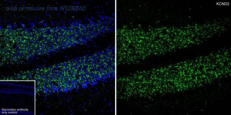 HUABIO HA601434 image 1