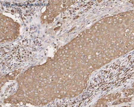 HUABIO HA610082 image 3