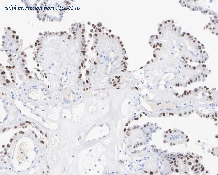 HUABIO HA610098 image 1