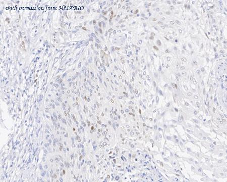 HUABIO HA610098 image 2