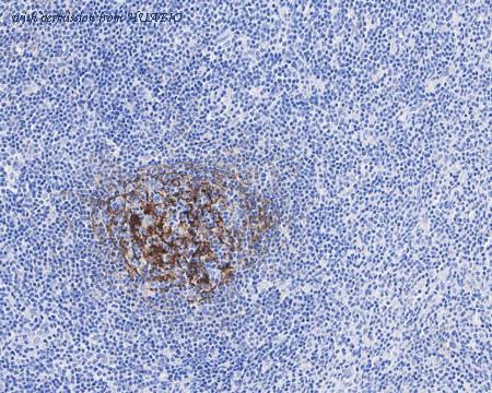 HUABIO HA610125 image 2