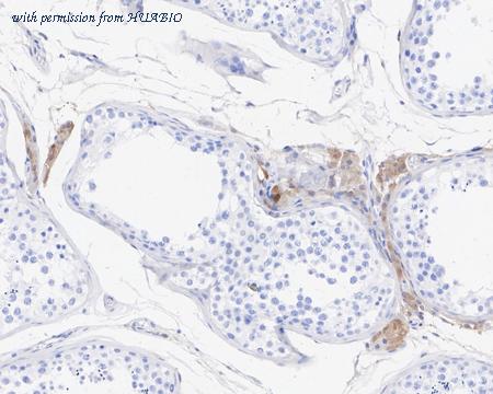 HUABIO HA610147 image 3