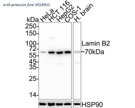 HUABIO HA610162 image 1