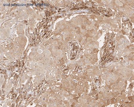 HUABIO HA610181 image 3