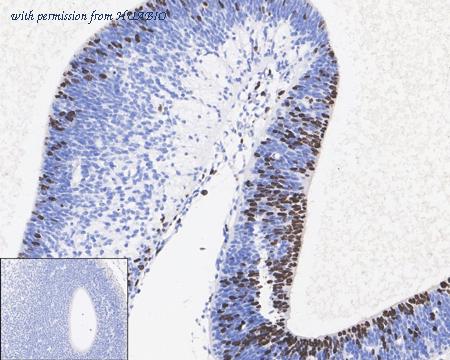 HUABIO HA610183 image 1