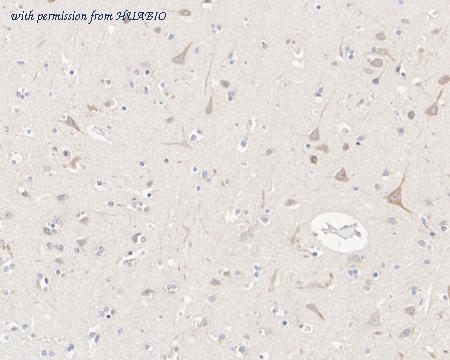 HUABIO HA610188 image 2