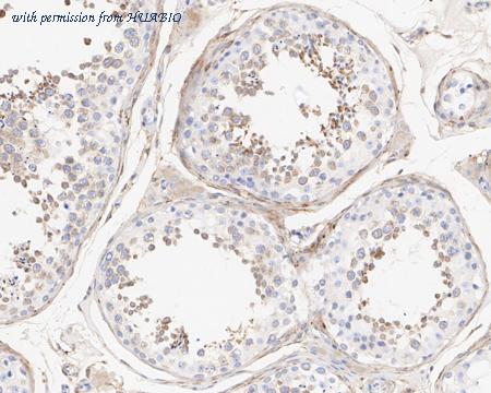 HUABIO HA610188 image 3