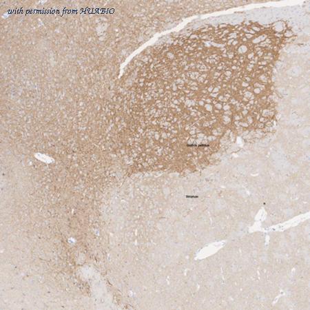 HUABIO HA610218 image 1