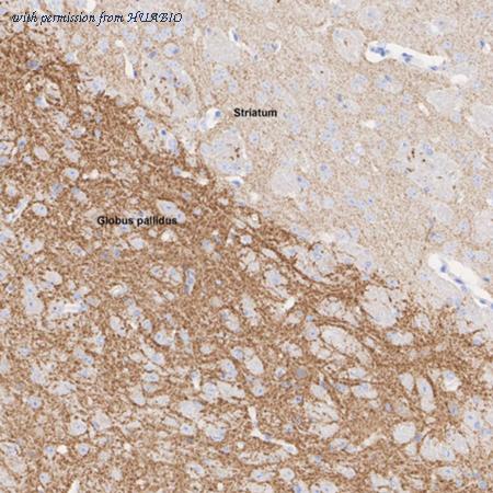 HUABIO HA610218 image 2