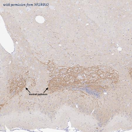 HUABIO HA610218 image 3