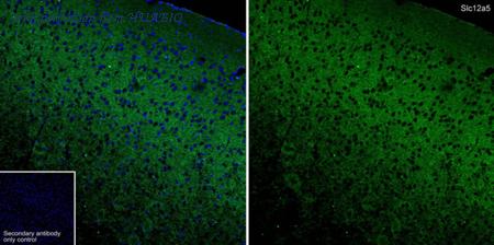 HUABIO HA610271 image 1