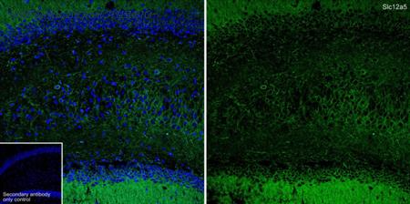 HUABIO HA610271 image 3