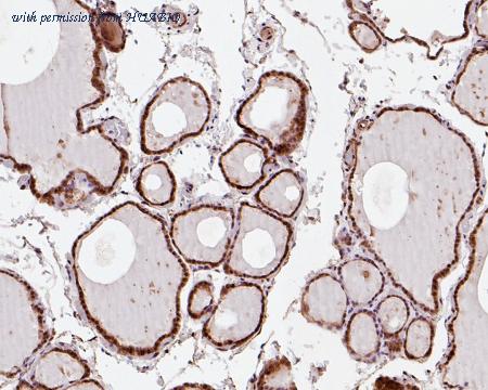 HUABIO HA720012 image 3