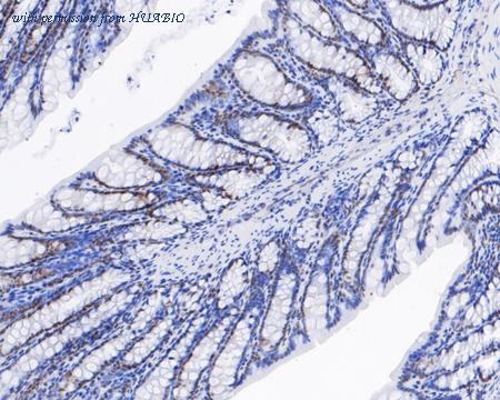 HUABIO HA720025 image 2