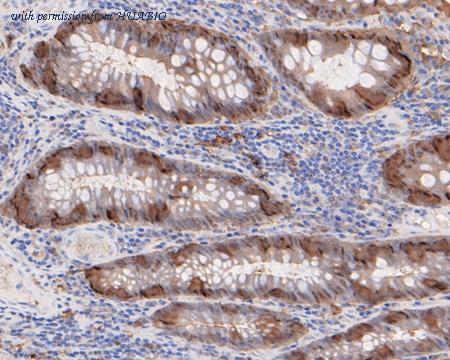 HUABIO HA720041 image 3