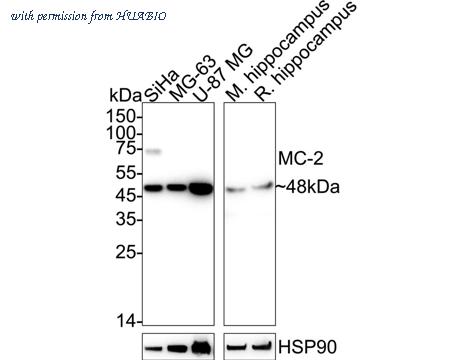HUABIO HA720055 image 1