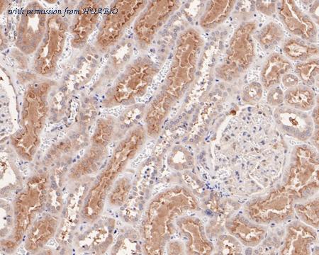 HUABIO HA720057 image 3