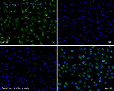 HUABIO HA720061 image 2