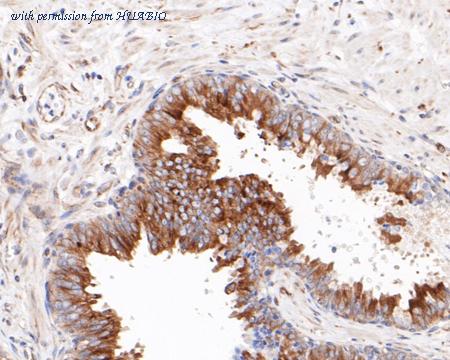 HUABIO HA720062 image 2