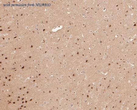 HUABIO HA720062 image 3