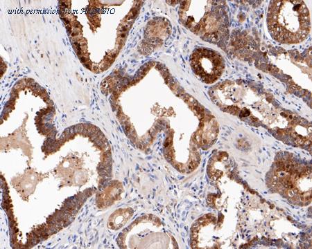 HUABIO HA720065 image 3