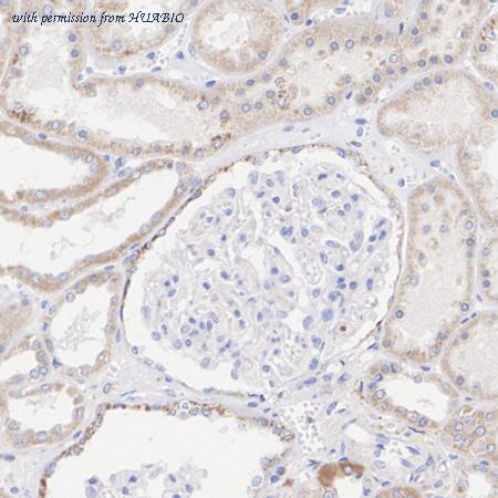 HUABIO HA720075 image 1