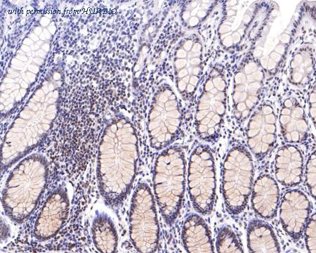 HUABIO HA720094 image 3