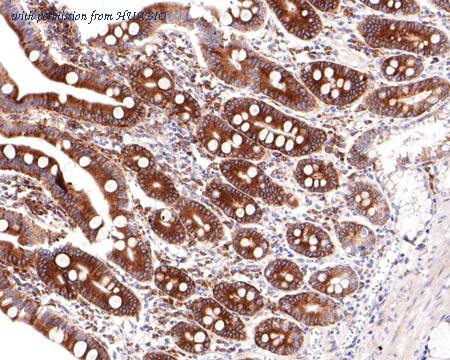 HUABIO HA720099 image 2