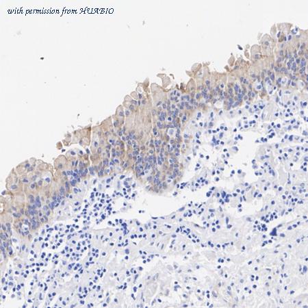 HUABIO HA720102 image 3