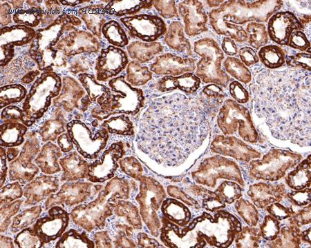 HUABIO HA720113 image 2