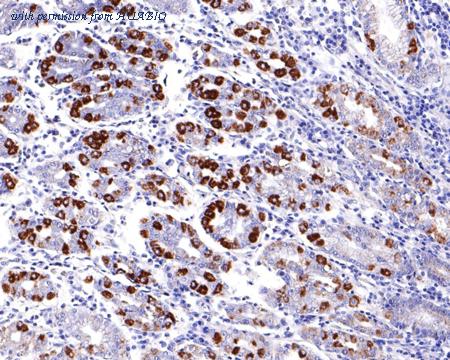 HUABIO HA720113 image 3