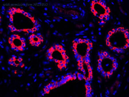 HUABIO HA720118F image 1