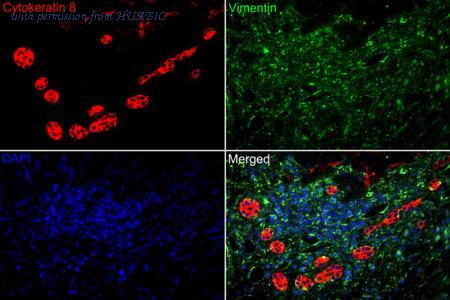 HUABIO HA720118F image 2