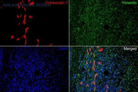 HUABIO HA720120F image 2
