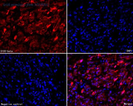 HUABIO HA720125F image 1