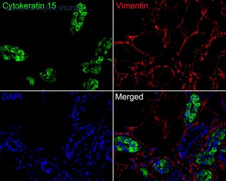 HUABIO HA720136F image 1