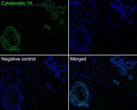 HUABIO HA720140F image 3