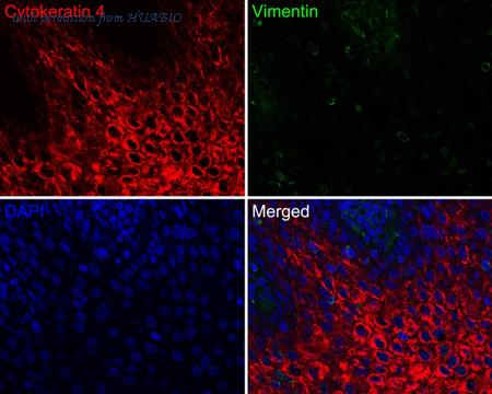 HUABIO HA720142F image 2