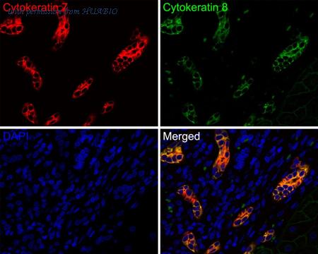 HUABIO HA720144F image 2